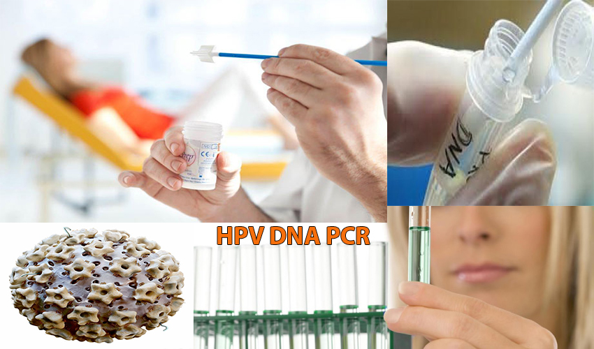HPV Testi HPV DNA PCR
