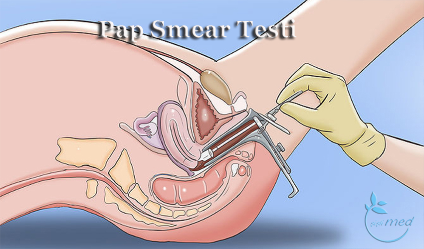Pap Smear Testi Nasıl Yapılır